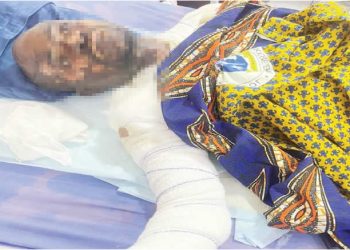 Jealous wife bathes husband with hot water for attending wedding alone