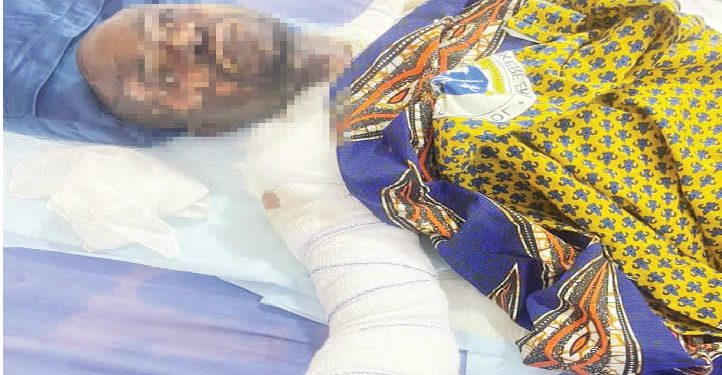 Jealous wife bathes husband with hot water for attending wedding alone