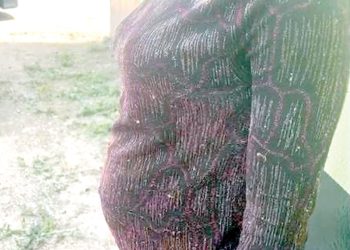 How prophet impregnated church member’s daughter after three years of copulation